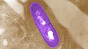 細菌を利用したがん治療研究 膵臓がん転移への新たな挑戦