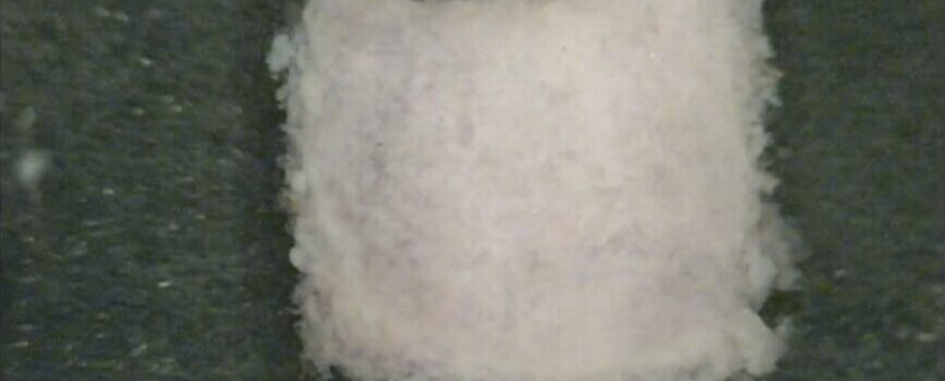 iPS細胞が拓く未来の医療 個性を活かす創薬